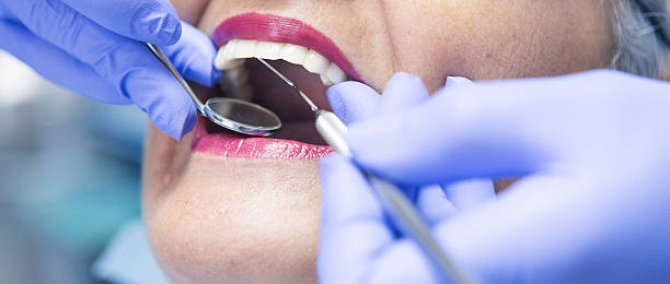 Best Teeth Whitening  in Plano, IL